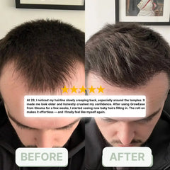 Evole Advanced Hair Growth Serum Roll-On | Rosemary, Redensyl & Aminexil (25ml)