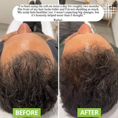 Evole Advanced Hair Growth Serum Roll-On | Rosemary, Redensyl & Aminexil (25ml)