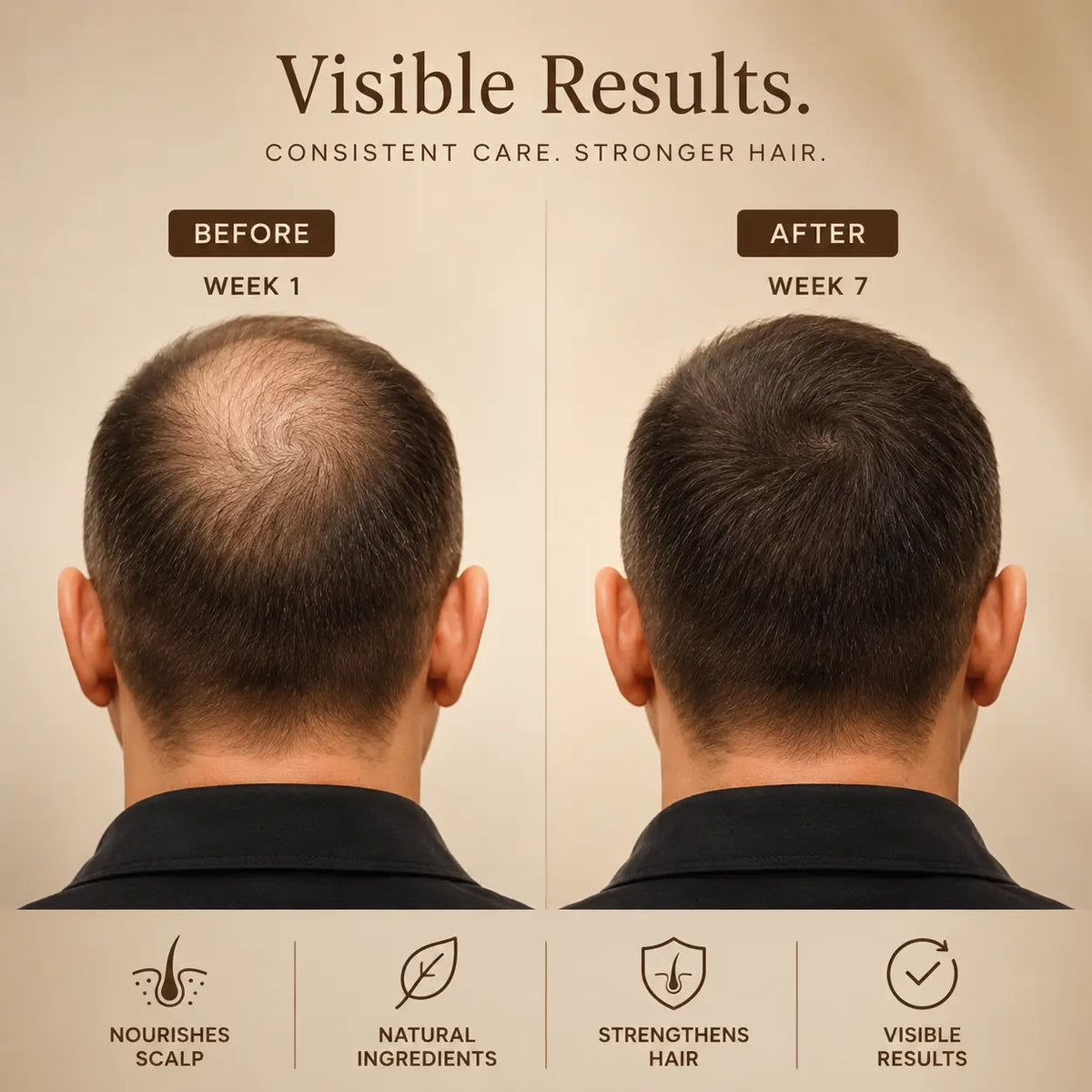 Evole Hair Growth Elixir | Scalp Care Serum (50 ml)