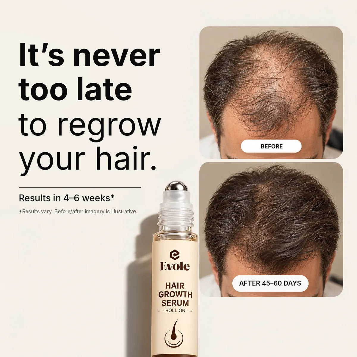 Evole Hair Growth Roll-On | Targeted Scalp Care Serum (25 ml)