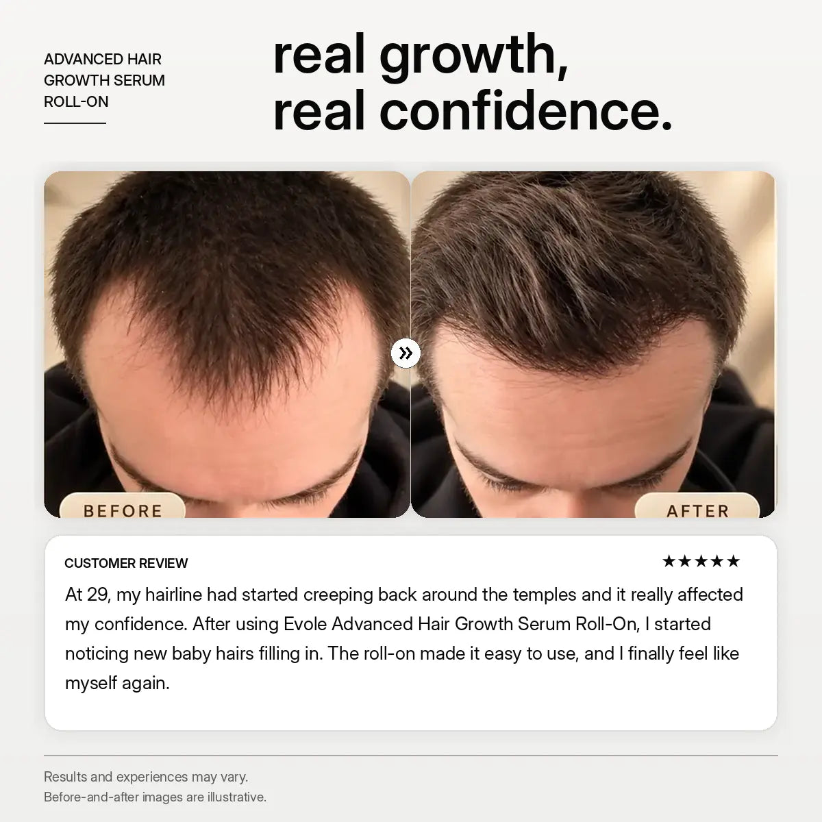 Evole Hair Growth Roll-On | Targeted Scalp Care Serum (25 ml)